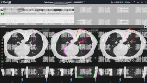 醫院電話機器人，提高醫療服務效率的新利器醫院電話機器人安裝示意圖